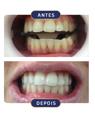 Prancheta 14 cópia 11